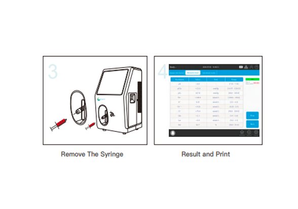 blood-gas-analyzer-282