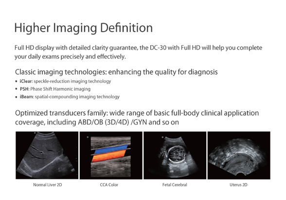 full-hd-ultrasound-mindray-117