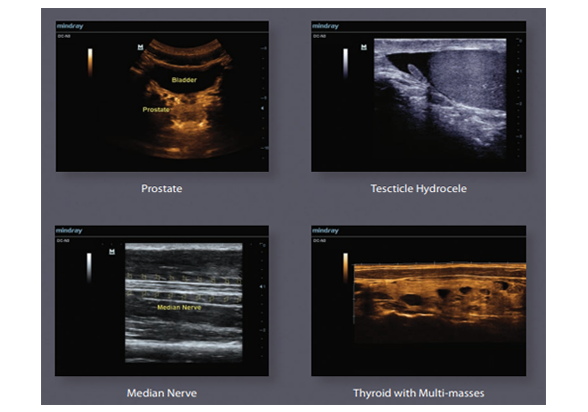 ultrasound-machine-mindray-198