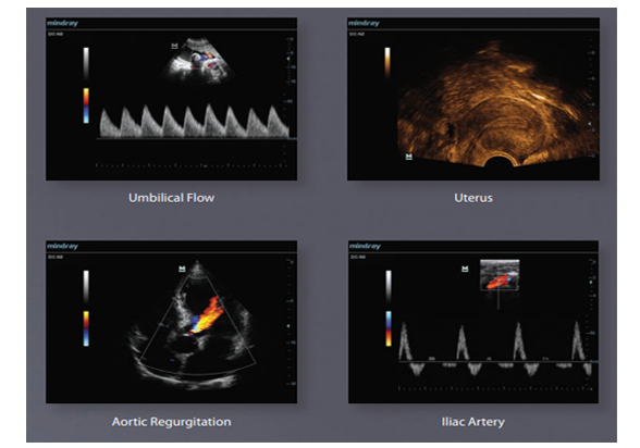 ultrasound-machine-mindray-198